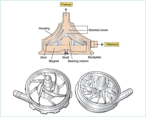 centrifugal pump in heart lung machine|centrifugal pump cpb.